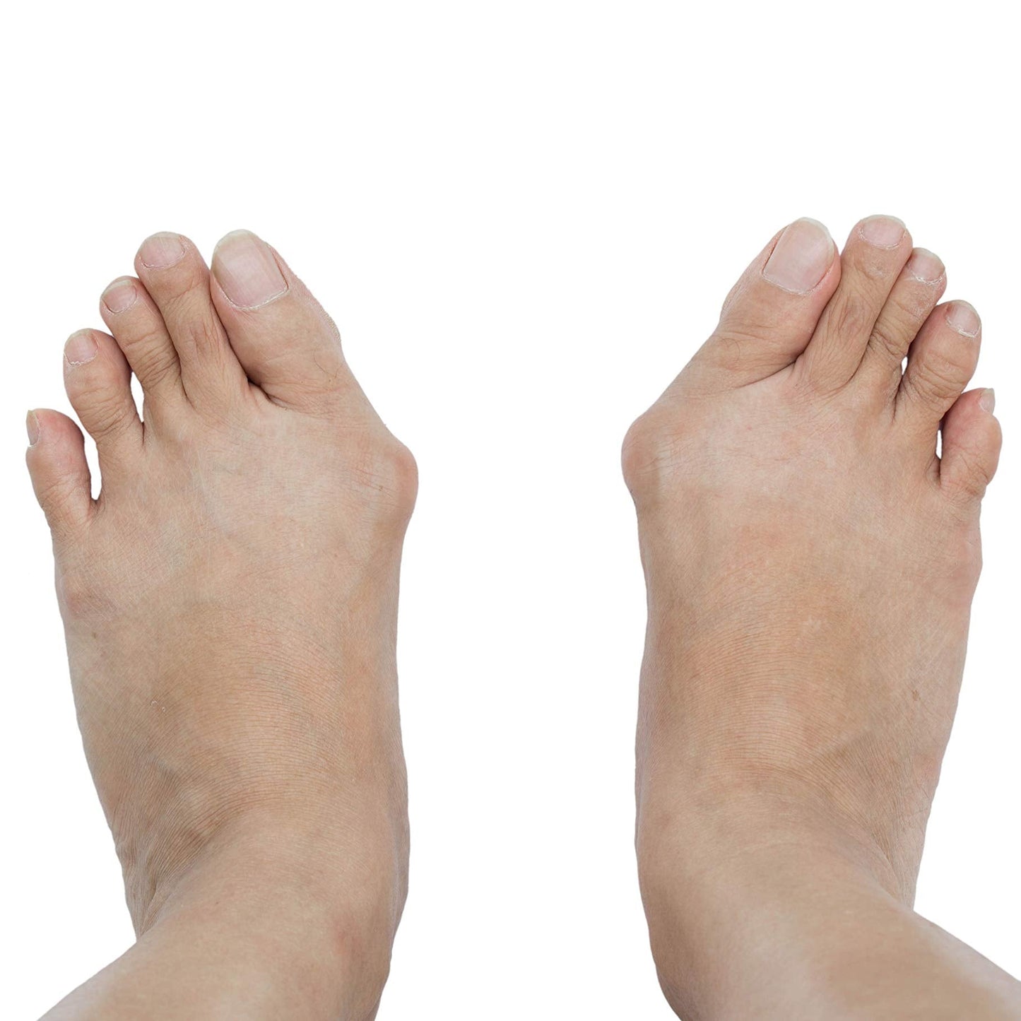 Pedag Bunion Gel One Size Foot | Love Leather Care