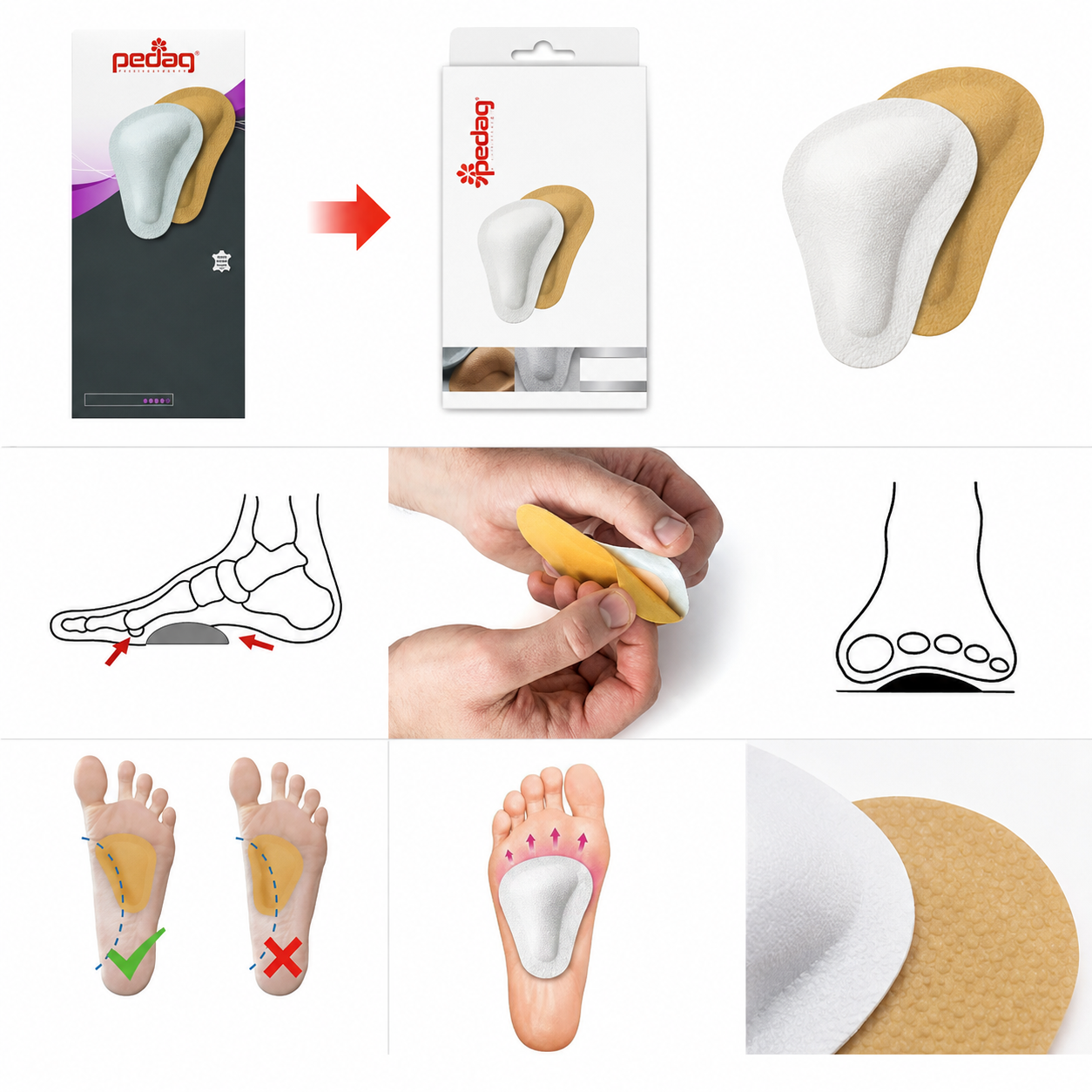 Pedag T-Form Metatarsal Pad Supports Cushions for Arch Relief