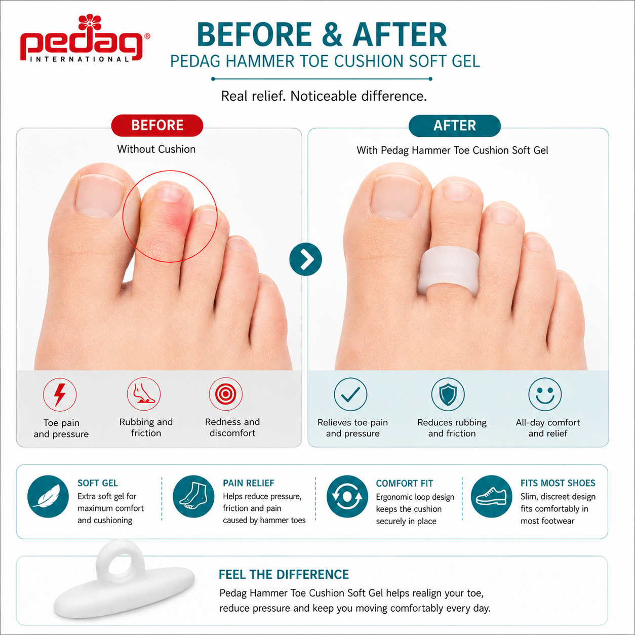 Pedag Hammer Toe Cushion Soft Gel Support