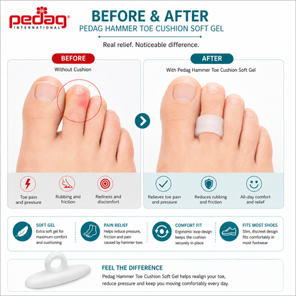 Pedag Hammer Toe Cushion Soft Gel Support