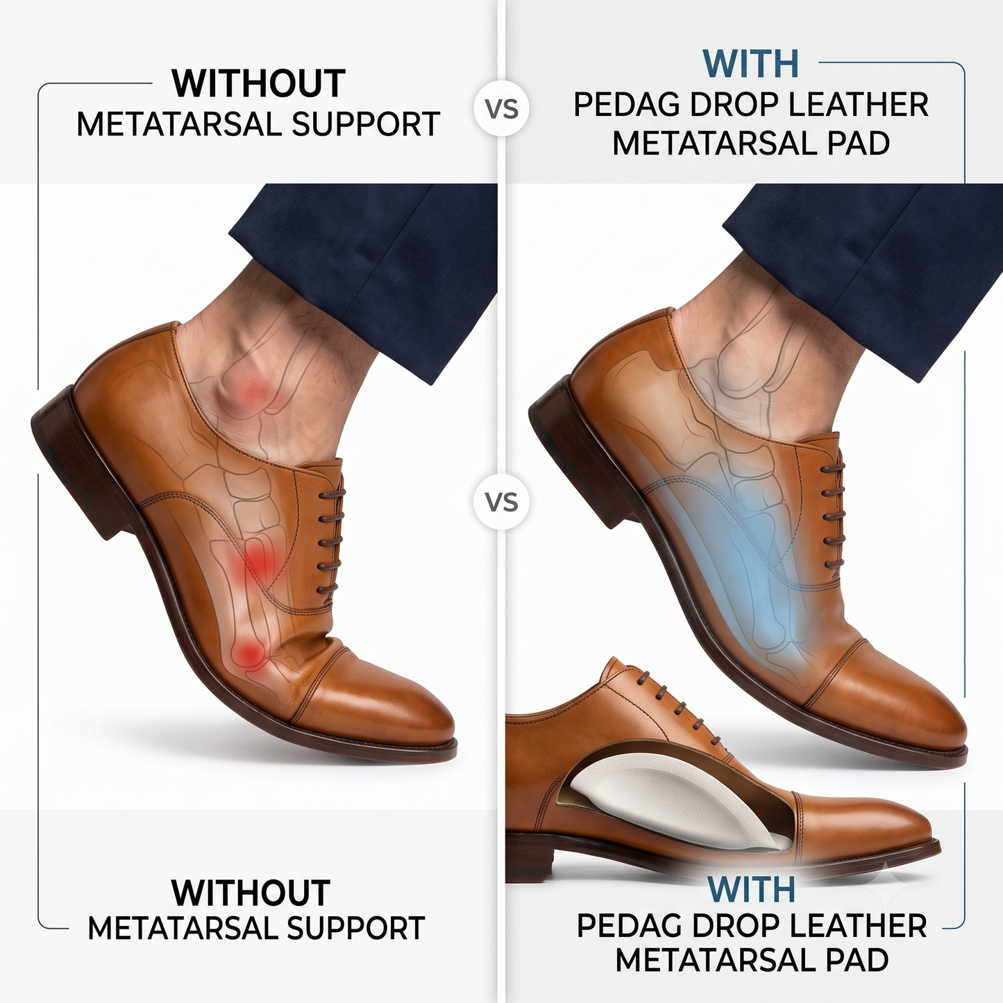 Metatarsal Pad Pedag Drop - Leather Support for Splayfoot in Shoes and Boots